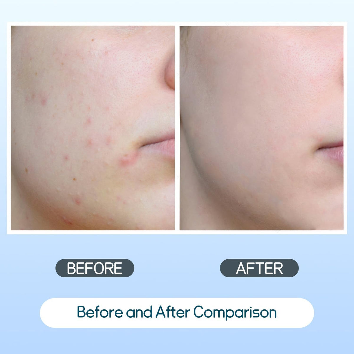 Salicylic Acid Toner Pads