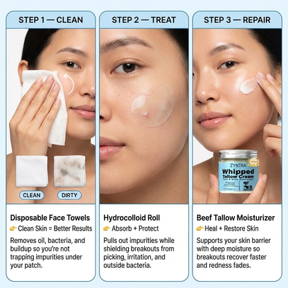 Zyntracosmetics 6 Month Clear Skin Treatment